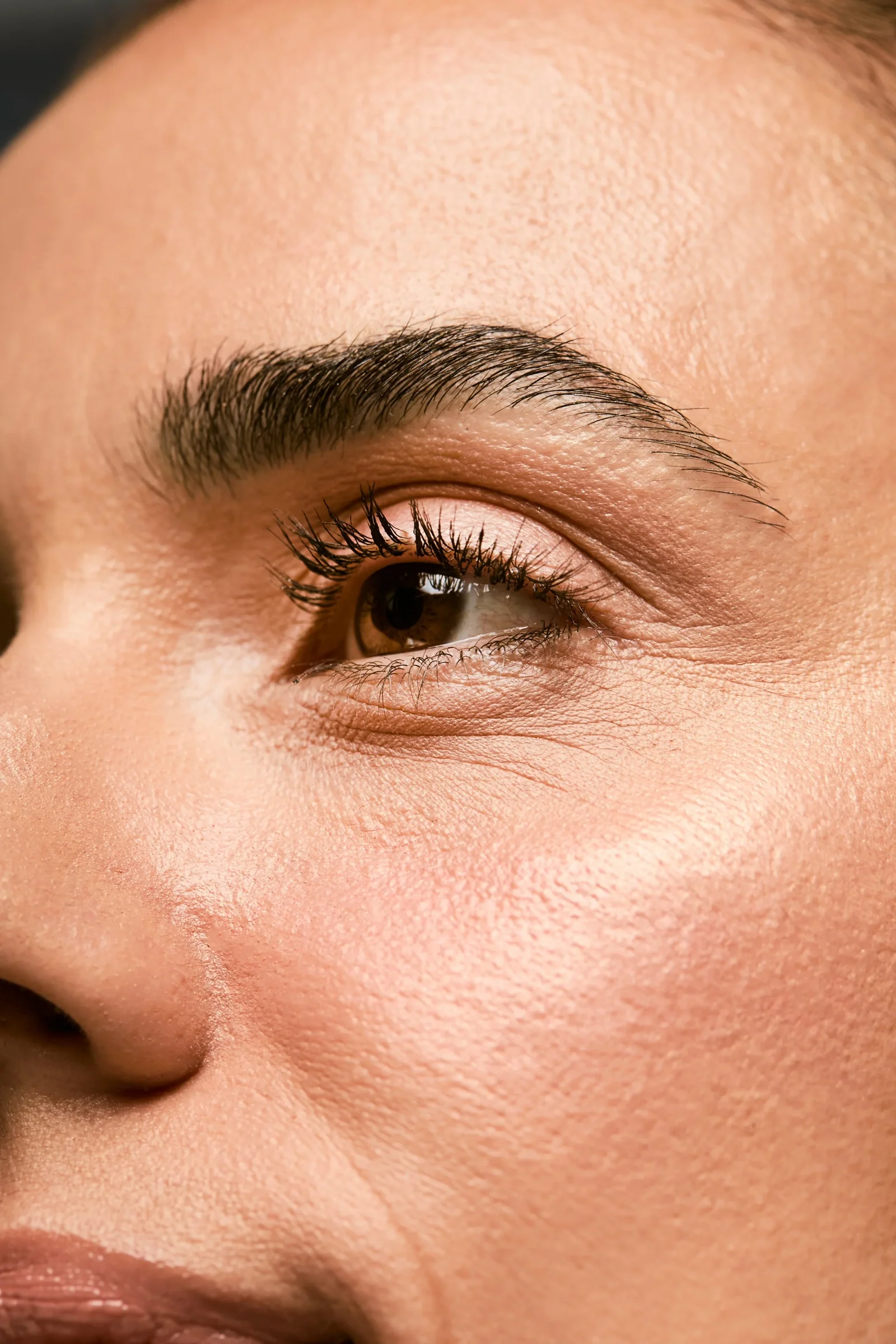 Como tratar olheiras de forma eficiente e segura